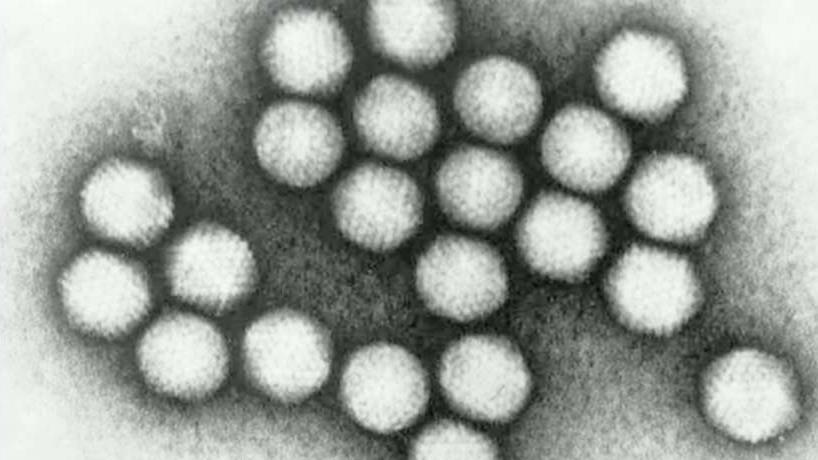 Fox News medical correspondent Dr. Marc Siegel says the adenovirus  outbreak found at the University of Maryland is worse than the flu.