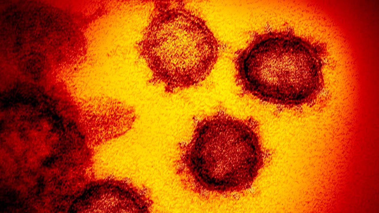 Officials lay out the plans to prevent coronavirus spread in the U.S.
